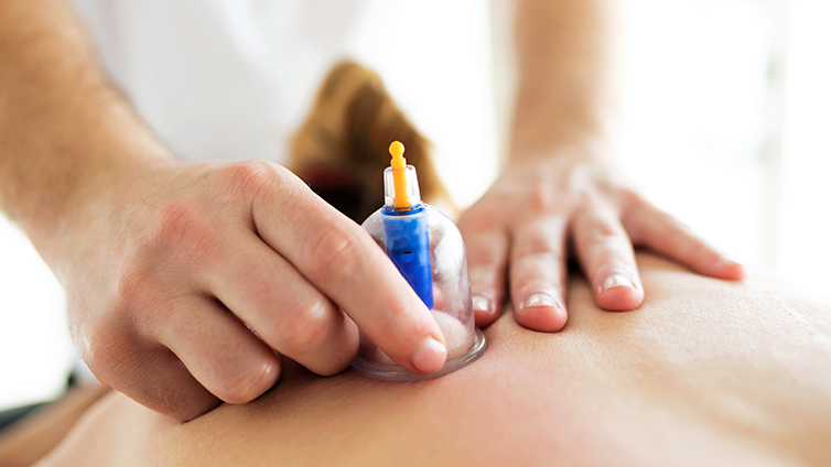 Hacamat Tedavisinin Faydaları - İzmir Hacamat | Dr. Mehmet Özkent