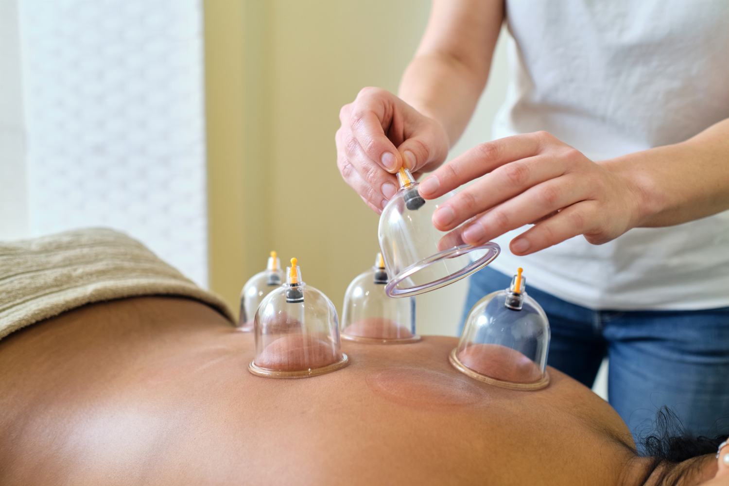 Hacamat Kimlere Yapılmaz? - İzmir Hacamat | Dr. Mehmet Özkent